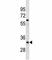 X-Ray Repair Cross Complementing 4 antibody, F46899-0.4ML, NSJ Bioreagents, Western Blot image 