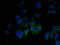 GLI Pathogenesis Related 1 antibody, A52864-100, Epigentek, Immunofluorescence image 