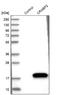 Cellular Retinoic Acid Binding Protein 2 antibody, NBP1-85465, Novus Biologicals, Western Blot image 