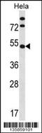 Inositol Hexakisphosphate Kinase 1 antibody, 58-476, ProSci, Western Blot image 