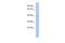 WD Repeat Domain 53 antibody, A17428, Boster Biological Technology, Western Blot image 