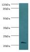 SSX Family Member 2B antibody, MBS1492183, MyBioSource, Western Blot image 