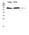 ZFP91 Zinc Finger Protein antibody, GTX34303, GeneTex, Western Blot image 