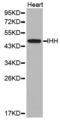 Indian Hedgehog Signaling Molecule antibody, abx126944, Abbexa, Western Blot image 