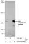DNA Polymerase Gamma, Catalytic Subunit antibody, GTX100398, GeneTex, Immunoprecipitation image 