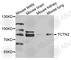 Tectonic Family Member 2 antibody, A8260, ABclonal Technology, Western Blot image 