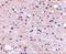 Autophagy And Beclin 1 Regulator 1 antibody, A03799, Boster Biological Technology, Immunohistochemistry paraffin image 