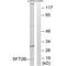 SFT2 Domain Containing 2 antibody, A13648, Boster Biological Technology, Western Blot image 