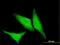 Heat Shock Protein Family B (Small) Member 1 antibody, H00003315-M04, Novus Biologicals, Immunocytochemistry image 