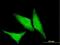 Heat Shock Protein Family B (Small) Member 1 antibody, H00003315-M04, Novus Biologicals, Immunocytochemistry image 