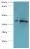 Casein Kinase 1 Alpha 1 Like antibody, LS-C378483, Lifespan Biosciences, Western Blot image 