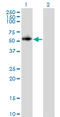 Protein Phosphatase 2 Regulatory Subunit Bgamma antibody, LS-C197970, Lifespan Biosciences, Western Blot image 
