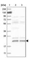 Chromosome 17 Open Reading Frame 49 antibody, PA5-54646, Invitrogen Antibodies, Western Blot image 