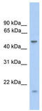 Zinc Finger Protein 213 antibody, TA339091, Origene, Western Blot image 