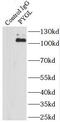 Glycogen phosphorylase, liver form antibody, FNab06975, FineTest, Immunoprecipitation image 