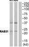 RAB31, Member RAS Oncogene Family antibody, TA315143, Origene, Western Blot image 
