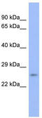 Proteasome Subunit Beta 6 antibody, TA342170, Origene, Western Blot image 