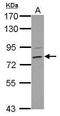 Holocarboxylase Synthetase antibody, GTX109815, GeneTex, Western Blot image 
