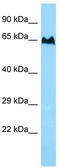 TBC1 domain family member 3 antibody, TA331236, Origene, Western Blot image 