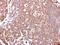 Mucin 4, Cell Surface Associated antibody, PA5-27267, Invitrogen Antibodies, Immunohistochemistry paraffin image 