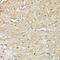 Thyroid Hormone Receptor Interactor 4 antibody, GTX66364, GeneTex, Immunohistochemistry paraffin image 