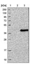 Solute Carrier Family 25 Member 36 antibody, NBP1-84617, Novus Biologicals, Western Blot image 