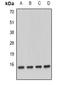 NADH:Ubiquinone Oxidoreductase Subunit A13 antibody, abx142093, Abbexa, Western Blot image 