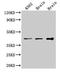 VPS26, Retromer Complex Component B antibody, LS-C377617, Lifespan Biosciences, Western Blot image 