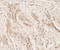 Interleukin-36 gamma antibody, LS-C201142, Lifespan Biosciences, Immunohistochemistry paraffin image 