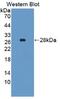 Glutamic--Pyruvic Transaminase antibody, abx131892, Abbexa, Western Blot image 