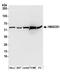 Hydroxymethylglutaryl-CoA synthase, cytoplasmic antibody, A304-590A, Bethyl Labs, Western Blot image 
