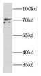 Dynein Cytoplasmic 1 Intermediate Chain 2 antibody, FNab02584, FineTest, Western Blot image 