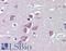 Transient receptor potential cation channel subfamily M member 2 antibody, LS-B4122, Lifespan Biosciences, Immunohistochemistry paraffin image 