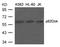Docking protein 1 antibody, A03039, Boster Biological Technology, Western Blot image 