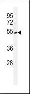 Tyrosyl-DNA Phosphodiesterase 2 antibody, 55-723, ProSci, Western Blot image 