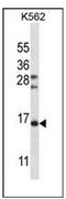 Follicle Stimulating Hormone Subunit Beta antibody, AP51730PU-N, Origene, Western Blot image 
