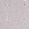 Centromere Protein T antibody, PA5-63512, Invitrogen Antibodies, Immunohistochemistry paraffin image 