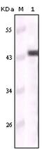 Keratin 5 antibody, 32-142, ProSci, Enzyme Linked Immunosorbent Assay image 