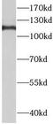 Transmembrane Protein 168 antibody, FNab08757, FineTest, Western Blot image 