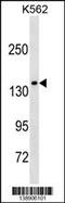 AF4/FMR2 family member 1 antibody, 59-975, ProSci, Western Blot image 