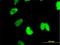 Catenin Beta Like 1 antibody, H00056259-M01, Novus Biologicals, Immunofluorescence image 