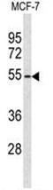 ADAM Like Decysin 1 antibody, AP50081PU-N, Origene, Western Blot image 