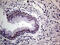 THO Complex 3 antibody, M12990, Boster Biological Technology, Immunohistochemistry paraffin image 