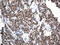 Lymphoid Enhancer Binding Factor 1 antibody, LS-C793159, Lifespan Biosciences, Immunohistochemistry paraffin image 