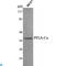 Protein Phosphatase 2 Catalytic Subunit Alpha antibody, LS-C814110, Lifespan Biosciences, Western Blot image 