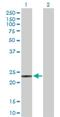 Phosphatidylethanolamine N-Methyltransferase antibody, H00010400-D01P, Novus Biologicals, Western Blot image 