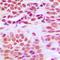 Histone Deacetylase 1 antibody, orb214035, Biorbyt, Immunohistochemistry paraffin image 