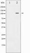 Protein Kinase D1 antibody, TA327891, Origene, Western Blot image 