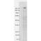 Transient Receptor Potential Cation Channel Subfamily M Member 7 antibody, MA5-27620, Invitrogen Antibodies, Western Blot image 