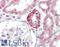 Interleukin 17 Receptor B antibody, LS-B15811, Lifespan Biosciences, Immunohistochemistry paraffin image 